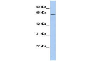WB Suggested Anti-ARSE Antibody Titration:  0. (Arylsulfatase E anticorps  (Middle Region))