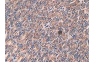 Detection of SLPI in Mouse Stomach Tissue using Polyclonal Antibody to Secretory Leukocyte Peptidase Inhibitor (SLPI)