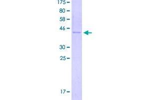 Image no. 1 for Lectin, Galactoside-Binding, Soluble, 2 (LGALS2) (AA 1-132) protein (GST tag) (ABIN2565224)