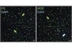 Immunohistochemistry of a systemically delivered ASO in mice. (ModDetect® 2'-O-Methoxyethyl (2'MOE) Panel)