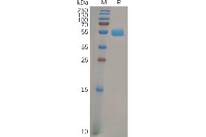 Human F Protein, mFc Tag on SDS-PAGE under reducing condition.