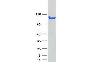 Validation with Western Blot