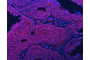 IF analysis of Septin 2/SEPTIN2 using anti-Septin 2/SEPTIN2 antibody (ABIN7599275). (Septin 2 anticorps  (AA 1-326))