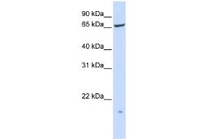 WB Suggested Anti-PIGT Antibody Titration:  0. (PIGT anticorps  (N-Term))