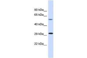 Host:  Rabbit  Target Name:  MAP4K1  Sample Type:  Fetal Muscle lysates  Antibody Dilution:  1.
