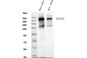 Western blot analysis of NUP214 using anti-NUP214 antibody (ABIN7601473).