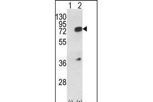 Western blot analysis of HNRPL (arrow) using rabbit polyclonal HNRPL Antibody (Center) (ABIN650774 and ABIN2839554). (HNRNPL anticorps  (AA 249-277))