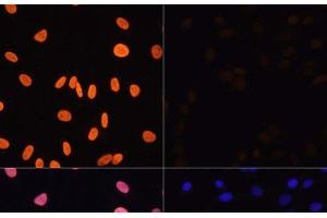 Immunofluorescence analysis of NIH/3T3 cells using Acetyl-Histone H3-K4 Polyclonal Antibody at dilution of 1:100. (Histone 3 anticorps  (acLys4))