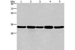 Western Blot analysis of LoVo and A549 cell, Human hepatocellular carcinoma tissue, Jurkat and Hela cell using E2F6 Polyclonal Antibody at dilution of 1:650 (E2F6 anticorps)
