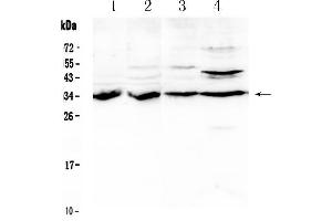 Western blot analysis of BRMS1 using anti- BRMS1 antibody . (BRMS1 anticorps  (AA 52-244))