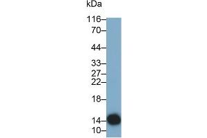 Detection of CST4 in Human Saliva using Monoclonal Antibody to Cystatin 4 (CST4) (CST4 anticorps  (AA 21-141))