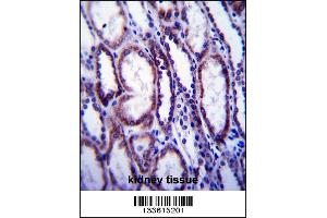 COL1A1 Antibody immunohistochemistry analysis in formalin fixed and paraffin embedded human kidney tissue followed by peroxidase conjugation of the secondary antibody and DAB staining.
