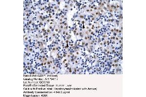 Human Liver (XRCC6 anticorps  (N-Term))