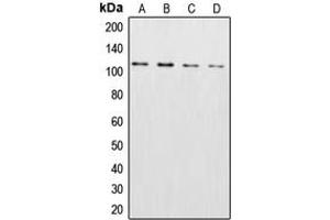 Western blot analysis of XPO2 expression in HeLa (A), NIH3T3 (B), SP2/0 (C), PC12 (D) whole cell lysates. (Exportin 2 anticorps  (N-Term))