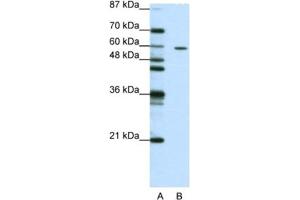 Western Blotting (WB) image for anti-Zinc Finger Protein 382 (ZNF382) antibody (ABIN2461958) (ZNF382 anticorps)