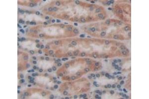 IHC-P analysis of kidney tissue, with DAB staining. (FNTA anticorps  (AA 51-366))