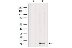 Western blot analysis of extracts from Mouse Myeloma cell, using DYNLRB1 Antibody. (DYNLRB1 anticorps  (Internal Region))