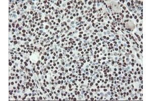 Image no. 9 for anti-Non-POU Domain Containing, Octamer-Binding (NONO) (AA 184-385) antibody (ABIN1491073) (NONO anticorps  (AA 184-385))