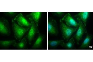 ICC/IF Image PPP1CB antibody detects PPP1CB protein at cytoplasm and nucleus by immunofluorescent analysis.