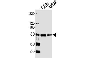 Lane 1: CEM cell lysates, Lane 2: Jurkat cell lysates probed with MYB (1279CT309. (MYB anticorps)