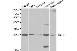 Western blot analysis of extracts of various cell lines, using RBP4 antibody (ABIN5970777) at 1/1000 dilution. (RBP4 anticorps)