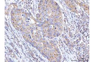 IHC analysis of C18orf22/RBFA using anti-C18orf22/RBFA antibody (ABIN7600106). (RBFA anticorps  (AA 15-319))