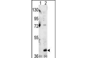 Western blot analysis of P38 (arrow) using P38 Antibody (C-term) (ABIN1882176 and ABIN2841644).
