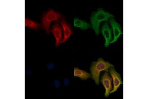 ABIN7093362 and ABIN7097382 staining Hela cells by IF/ICC.