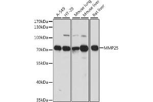 Western blot analysis of extracts of various cell lines, using MMP25 antibody (ABIN7268422) at 1:1000 dilution. (MMP25 anticorps  (AA 350-540))
