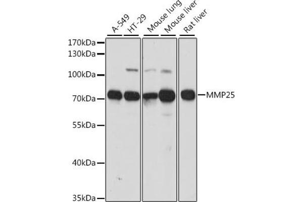 MMP25 anticorps  (AA 350-540)