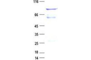 Validation with Western Blot