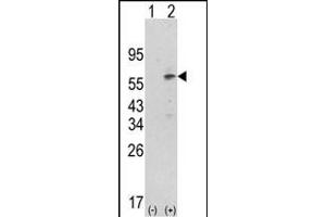 Western blot analysis of PDK1 (arrow) using rabbit polyclonal hPDK1-G14 (ABIN391036 and ABIN2841202). (PDPK1 anticorps  (N-Term))