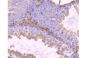 Paraformaldehyde-fixed, paraffin embedded mouse testis, Antigen retrieval by boiling in sodium citrate buffer (pH6.