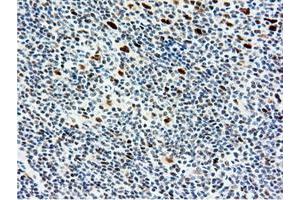 Image no. 8 for anti-5'-Nucleotidase Domain Containing 1 (NT5DC1) antibody (ABIN1499838)