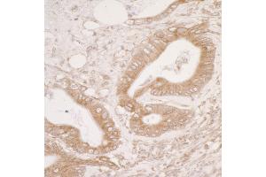 Immunohistochemistry (IHC) image for anti-Protein Disulfide Isomerase Family A, Member 3 (PDIA3) (AA 50-100) antibody (ABIN7453944)