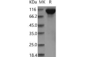 Western Blotting (WB) image for Epidermal Growth Factor Receptor (EGFR) (Active) protein (His tag) (ABIN7321215)