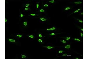 Immunofluorescence of monoclonal antibody to OXSR1 on HeLa cell.
