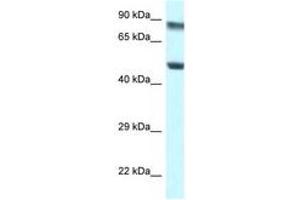 Image no. 1 for anti-Pseudouridylate Synthase 1 (PUS1) (AA 88-137) antibody (ABIN6747496) (PUS1 anticorps  (AA 88-137))