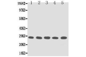 Anti-TFPI2 antibody, Western blotting Lane 1: MM453 Cell Lysate Lane 2: MM231 Cell Lysate Lane 3: HELA Cell Lysate Lane 4:  Cell Lysate Lane 5: JURKAT Cell Lysate (TFPI2 anticorps  (Middle Region))
