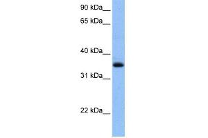 WB Suggested Anti-CHN2 Antibody Titration: 0. (CHN2 anticorps  (N-Term))