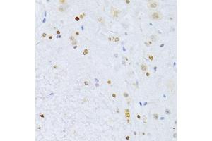 Immunohistochemistry of paraffin-embedded mouse spinal cord using ZEB2 antibody (ABIN5973336) at dilution of 1/100 (40x lens). (ZEB2 anticorps)