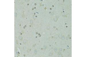 Immunohistochemistry of paraffin-embedded rat brain using GTF2H2C antibody  at dilution of 1:100 (40x lens). (GTF2H2C anticorps  (AA 1-300))