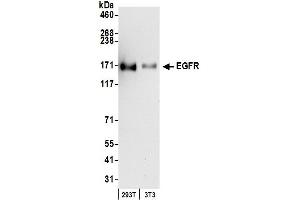 Western Blotting (WB) image for anti-Epidermal Growth Factor Receptor (EGFR) (C-Term) antibody (ABIN7454624) (EGFR anticorps  (C-Term))