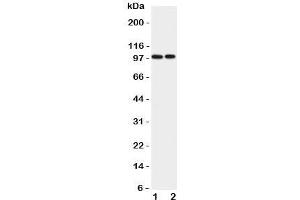 Western blot testing of EPB41L1 antibody and Lane 1:  rat brain;  2: mouse brain lysate. (EPB41L1 anticorps  (C-Term))