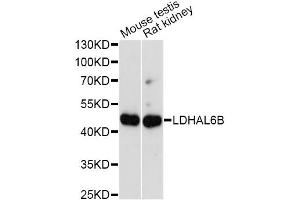 Western blot analysis of extracts of various cell lines, using LDHAL6B antibody. (LDHAL6B anticorps)