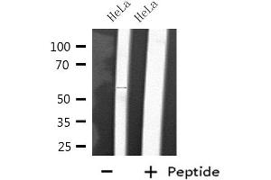Western blot analysis of extracts from HeLa cells, using CYP2D6 antibody. (CYP2D6 anticorps)