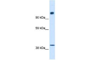 WB Suggested Anti-NCOR1 Antibody Titration:  0. (NCOR1 anticorps  (N-Term))