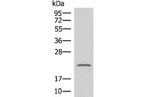 Western blot analysis of Human fetal liver tissue lysate using IFNA8 Polyclonal Antibody at dilution of 1:500 (IFNA8 anticorps)