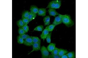 IF analysis of PPID using anti-PPID antibody (ABIN6719438). (PPID anticorps  (AA 306-370))