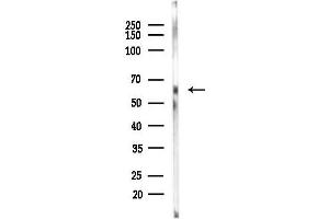 Western blot analysis of lysates from PC12 cells(uv30 min treatment), using MSLN Antibody at 1/1000 dilution.